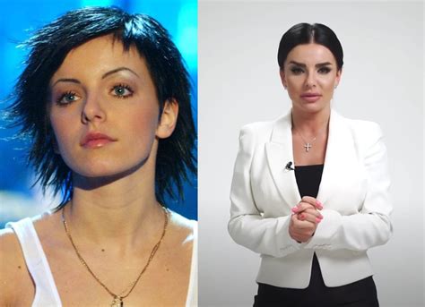 Julia Volkova: Minä olen naamakirurgiaan ja Venäjän poptähden paluu musiikkimaailmaan!